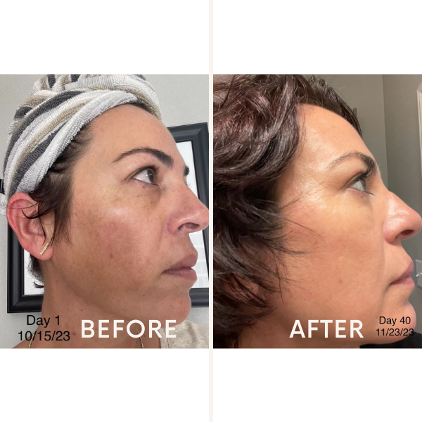 Skincare Junkie Discoloration Fade Wand Face Serums   