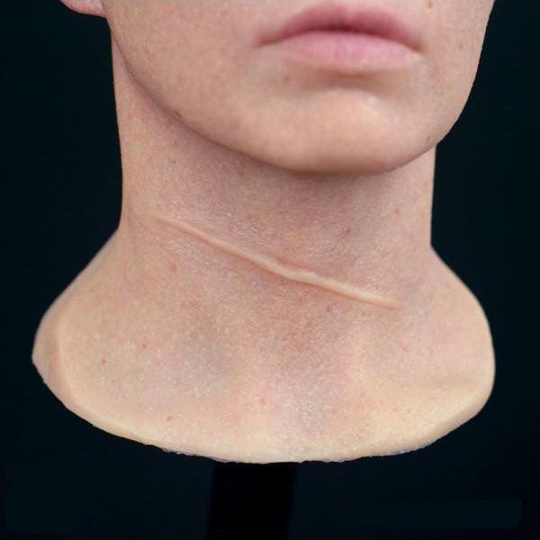 Out of Kit Single Scar (Large) Prosthetic Appliances   