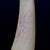 Out of Kit Healed Burn Scar 3 Prosthetic Appliances   